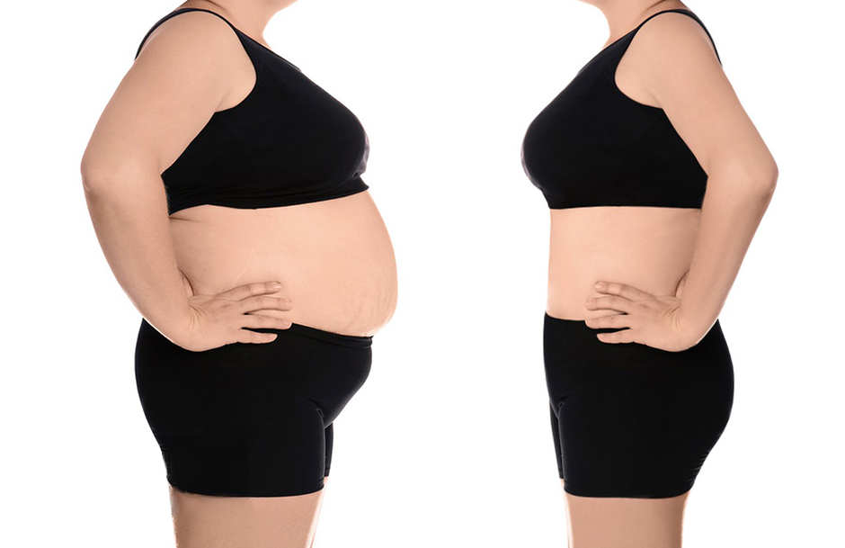 40k ultrasound cavitation body slimming before and after